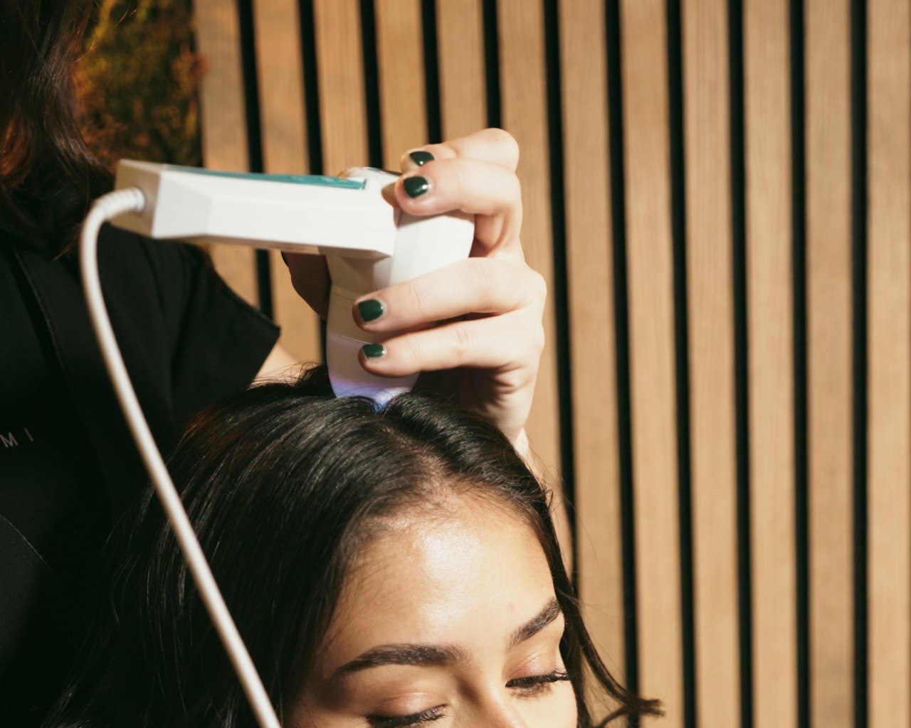 Diagnostic cuir chevelu